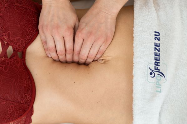 diastasis recti treatment Woolwich