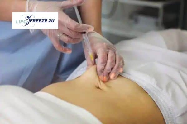 Fat Dissolving Injections Woolwich & Weight loss medication