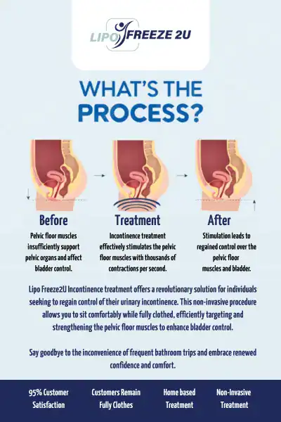 Diagram of how incontinence treatment Woolwich works.