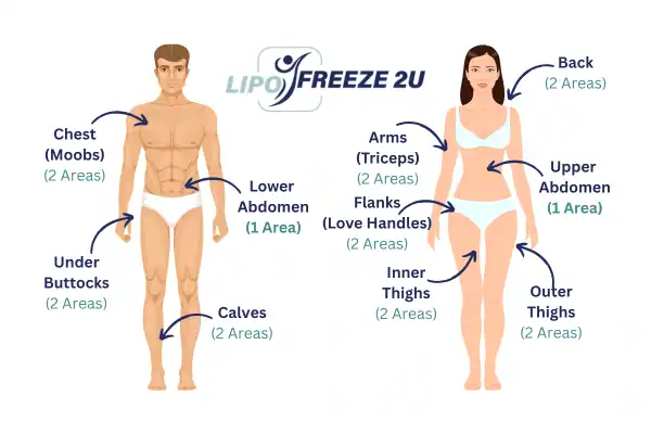 Areas you can have fat freezing treatment Woolwich
