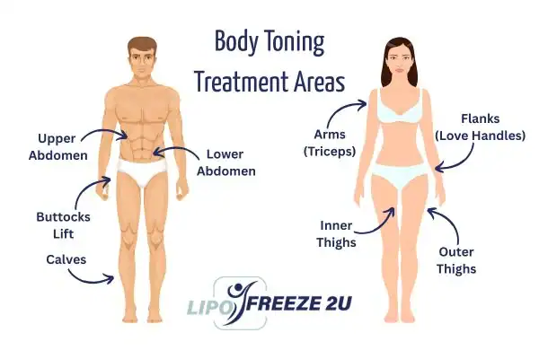 Graphic showing where you can have Body toning Treatment Woolwich on your body
