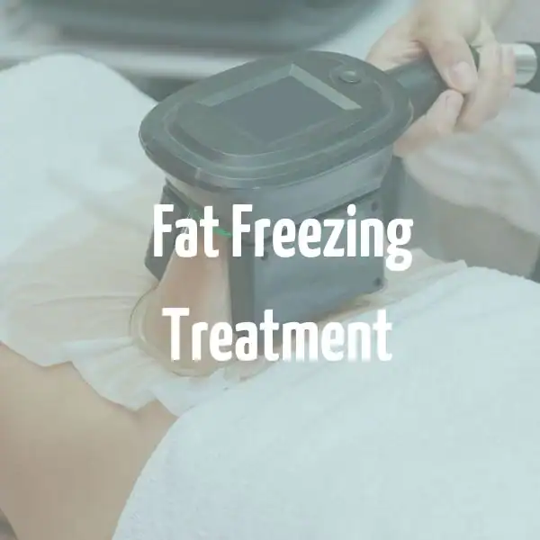 fat freezing treatment Woolwich