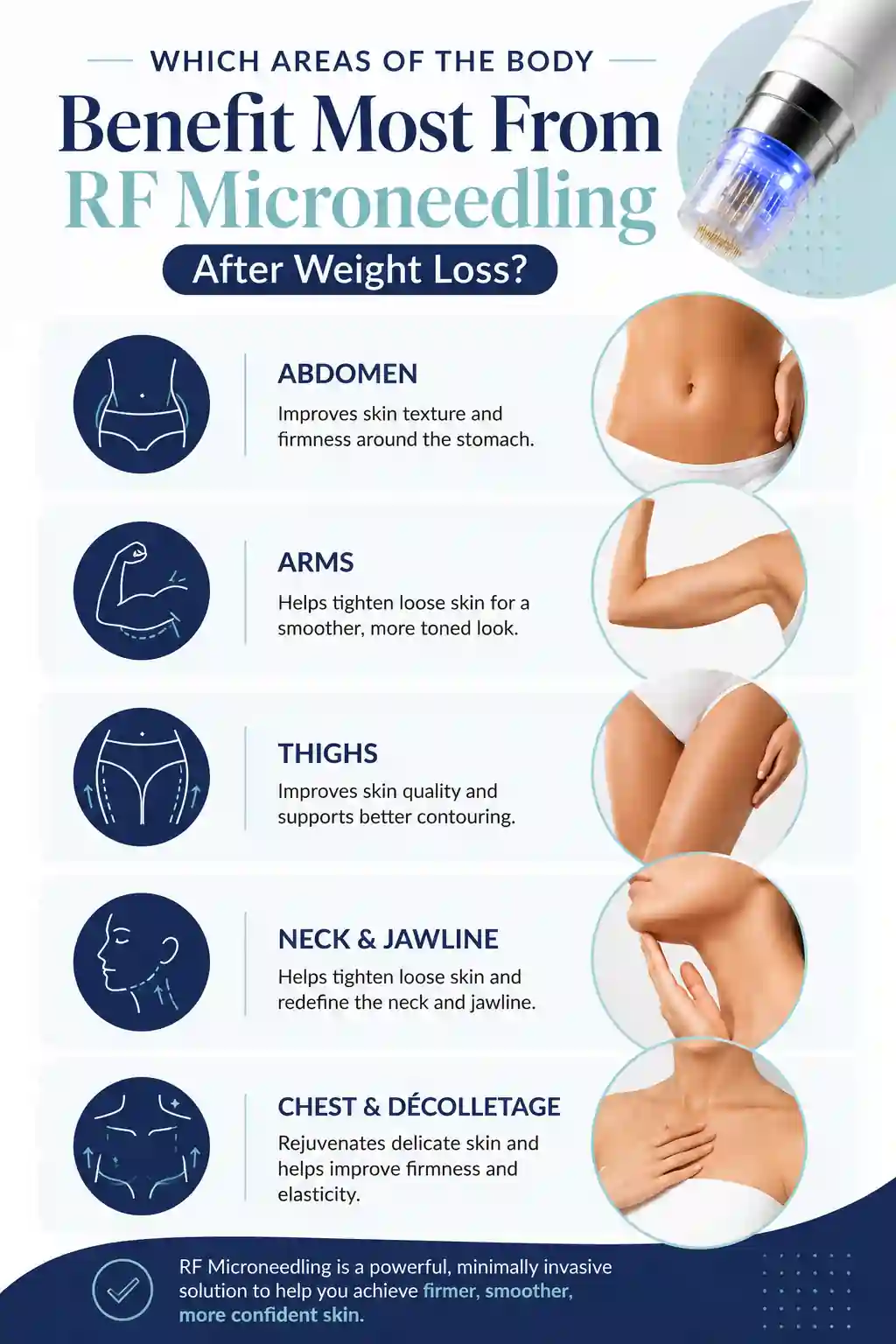 Which Areas of the Body Benefit Most From RF Microneedling After Weight Loss Woolwich